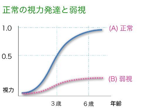 弱視